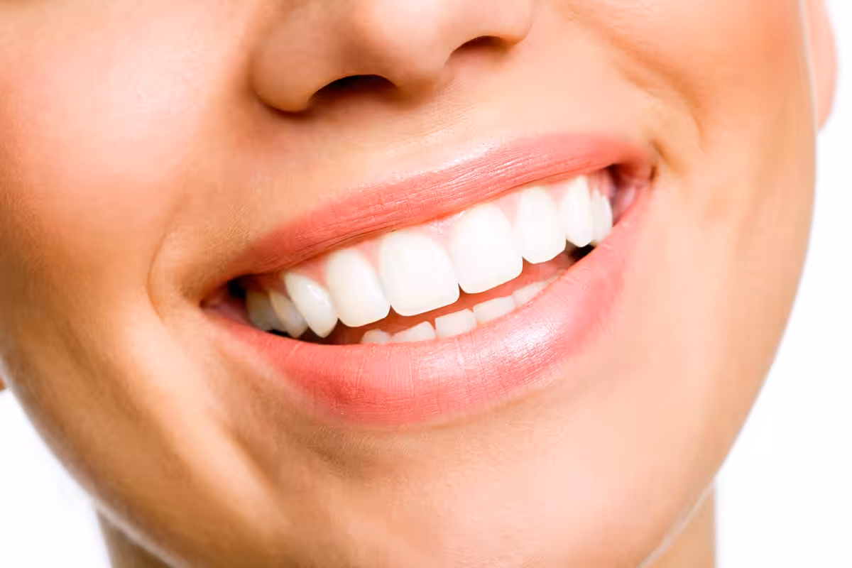 Can You Whiten Your Teeth Too Much?