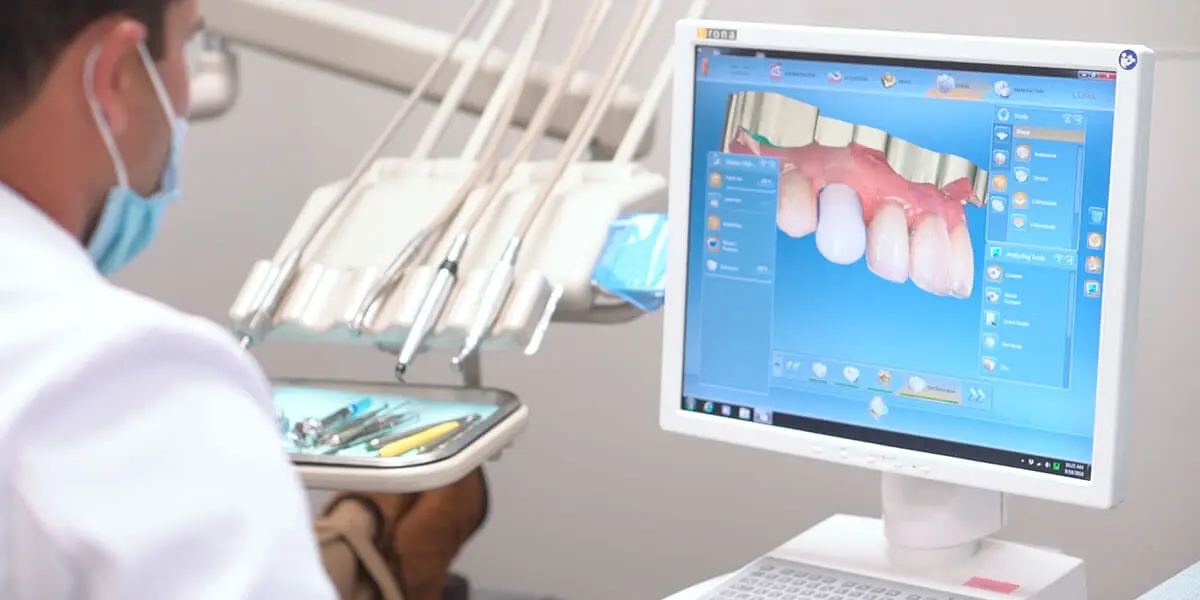 Dental crowns illustration