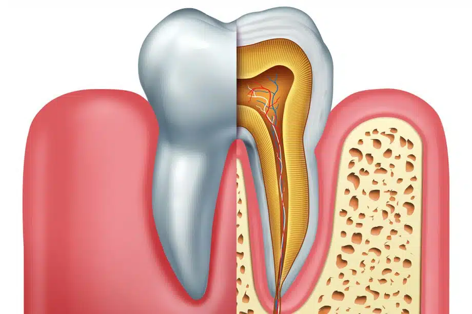 How Long Does A Root Canal Take?