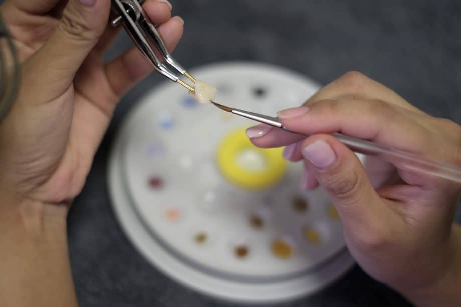 Are CEREC Crowns Suitable for Patients with Grinding Habits? What to Consider