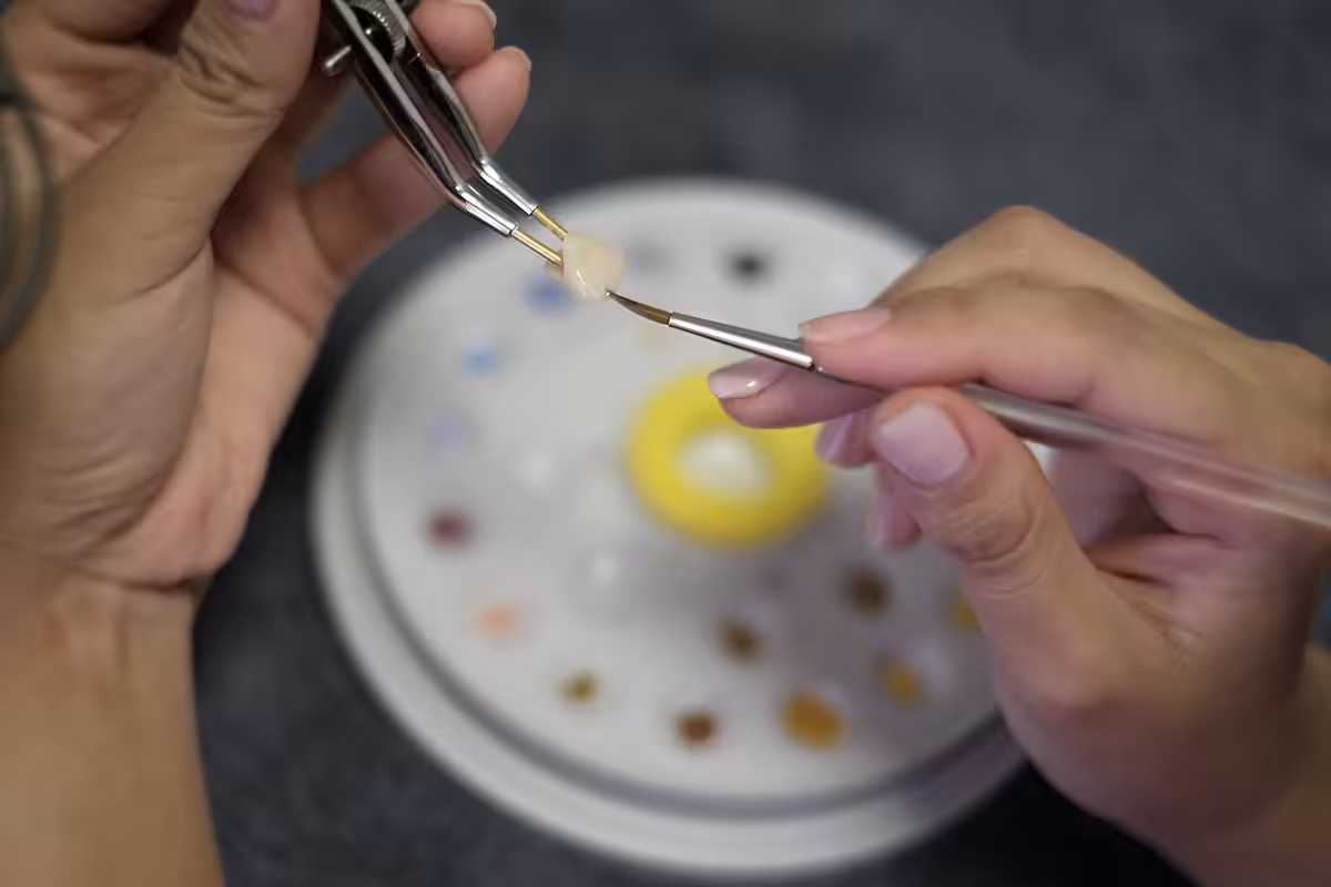 Are CEREC Crowns Suitable for Patients with Grinding Habits? What to Consider
